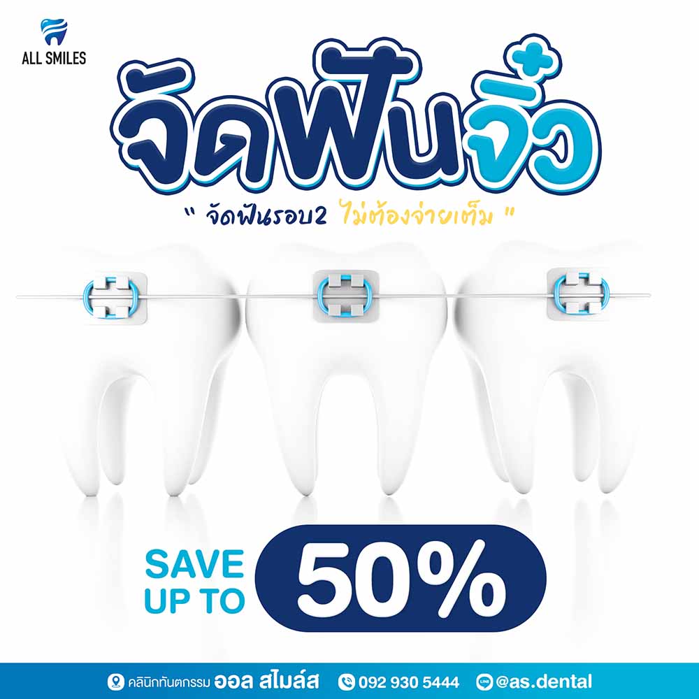 จัดฟันรอบ2